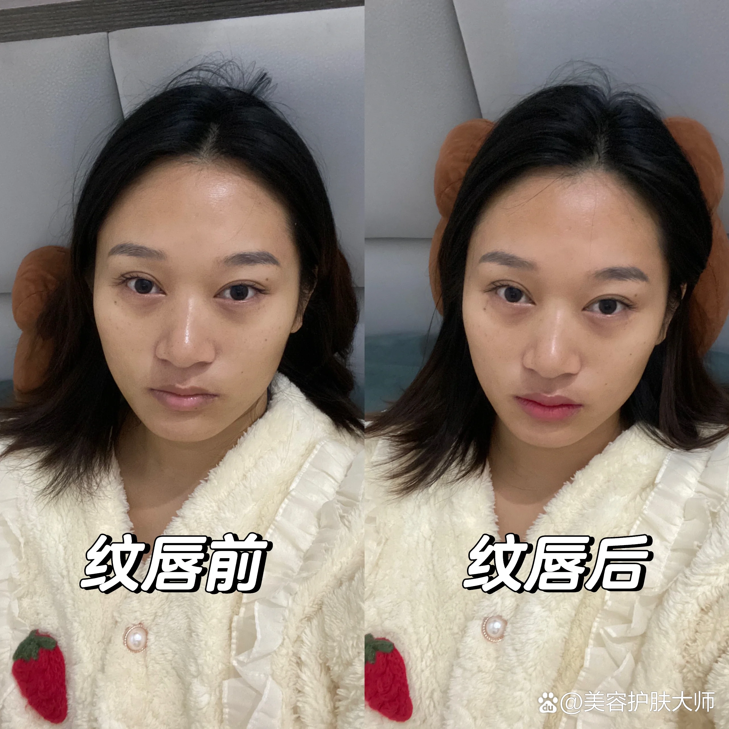 漂唇的坏处有什么